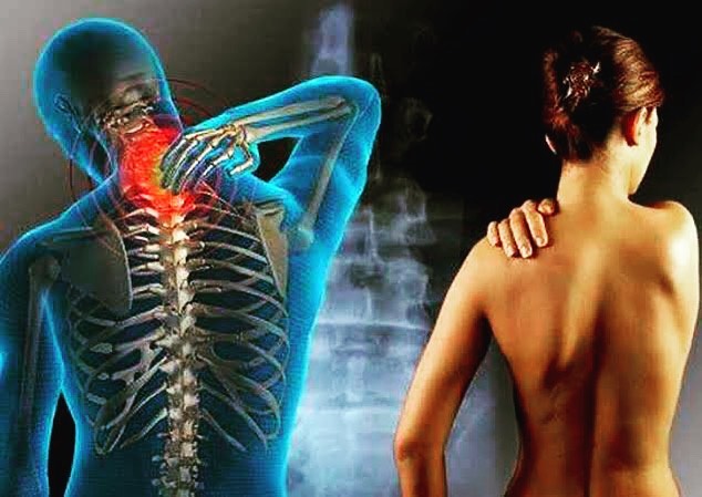 FİBROMYALJİ TERAPİSİ